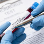 Coronavirus: nuovo aumento di casi +351 rispetto a ieri